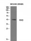 CD240d Polyclonal Antibody