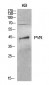 CD155 Polyclonal Antibody