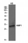 EMAP II Polyclonal Antibody