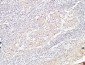 BMP-15 Polyclonal Antibody