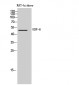 GDF-6 Polyclonal Antibody