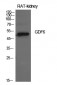 GDF-6 Polyclonal Antibody