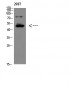 GDF-6 Polyclonal Antibody