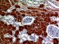 RNase III Drosha Polyclonal Antibody