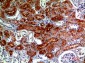 RNase III Drosha Polyclonal Antibody