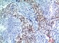 p53 Polyclonal Antibody