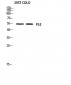 p53 Polyclonal Antibody