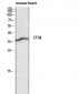 Cathepsin B Polyclonal Antibody