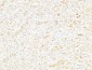 CD26 Polyclonal Antibody