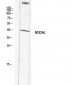 Nodal Polyclonal Antibody