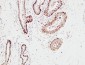 S-100 α Polyclonal Antibody