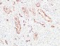 S-100 α Polyclonal Antibody