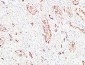 S-100 α Polyclonal Antibody
