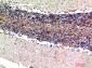 S-100 α Polyclonal Antibody