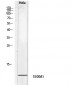 S-100 α Polyclonal Antibody