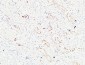 K-Ras Polyclonal Antibody