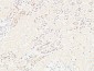 E-Selectin Polyclonal Antibody