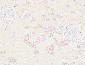 E-Selectin Polyclonal Antibody