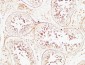 PTEN Polyclonal Antibody