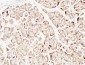 PTEN Polyclonal Antibody