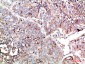 PTEN Polyclonal Antibody