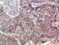 PTEN Polyclonal Antibody