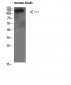 Collagen IV  Polyclonal Antibody