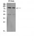 Amyloid-β Polyclonal Antibody