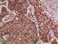 TRIF Polyclonal Antibody