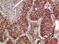 TRIF Polyclonal Antibody