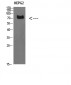 TRIF Polyclonal Antibody