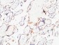 ETBR Polyclonal Antibody