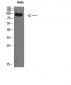 VPS35 Polyclonal Antibody