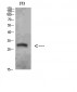 Nanos Homologue 1 (NANOS1) Polyclonal Antibody