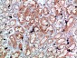 Perforin 1 Polyclonal Antibody