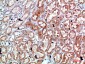 Perforin 1 Polyclonal Antibody