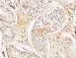 ALB Polyclonal Antibody