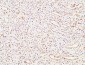 ALB Polyclonal Antibody