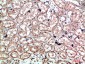 Caldesmon Polyclonal Antibody