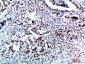 Vimentin Polyclonal Antibody