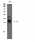 TIMP-4 Polyclonal Antibody