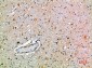 SPOP Polyclonal Antibody