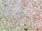 SPOP Polyclonal Antibody