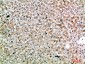 SPOP Polyclonal Antibody