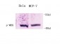 MEK-1 Polyclonal Antibody