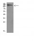 ULK2 Polyclonal Antibody