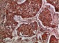 Imp3 Polyclonal Antibody