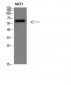 Parathyroid hormone/parathyroid hormone-related peptide receptor Polyclonal Antibody