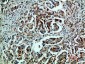 GRP78 BiP Polyclonal Antibody