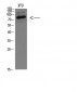 GRP78 BiP Polyclonal Antibody